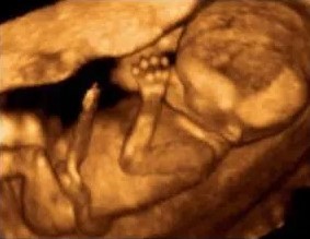 Embryo